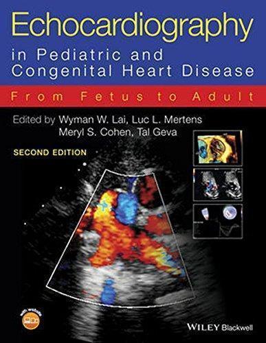 Echocardiography In Pediatric And Congenital Heart Disease From Fetus To Adult 2Nd Edition