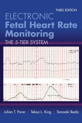 Electronic Fetal Heart Rate Monitoring The 5 Tier System 3Rd Edition
