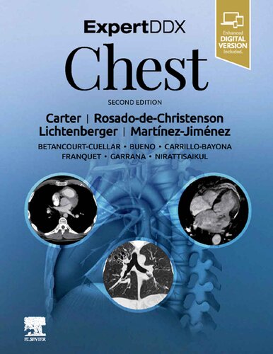 ExpertDDx: Chest