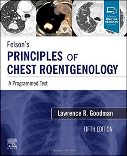 FelsonÃ¢â‚¬â„¢s Principles of Chest Roentgenology: A Programmed Text