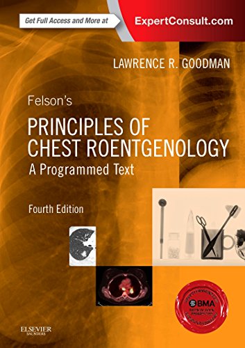 Felson?s Principles of Chest Roentgenology 4th Edition
