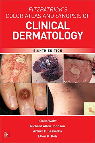 Fitzpatrick?s Color Atlas and Synopsis of Clinical Dermatology (8th Edition)