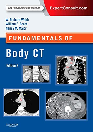 Fundamentals of Body CT, 4e -Fundamentals of Radiology 4th Edition