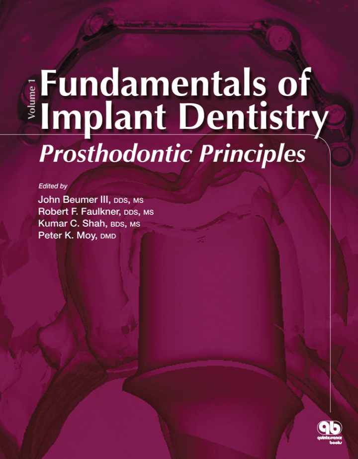 Fundamentals of Implant Dentistry: Prosthodontic Principles: Volume 1