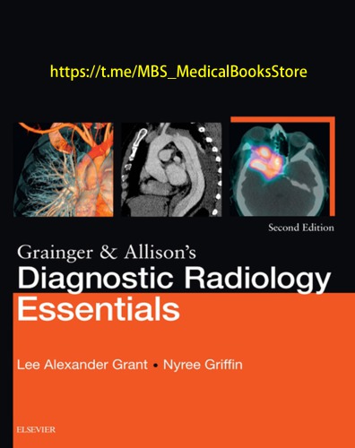 Grainger and Allison's Diagnostic Radiology Essentials E-Book