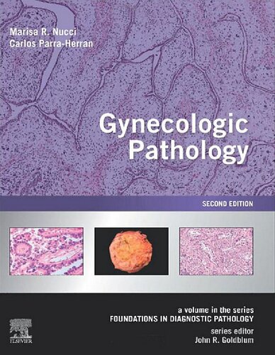 Gynecologic Pathology: A Volume in Foundations in Diagnostic Pathology Series