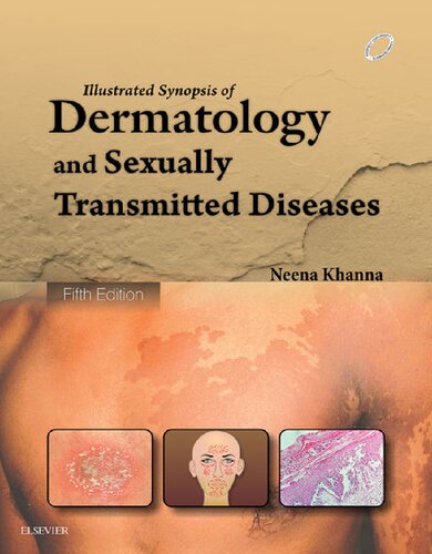 Illustrated Synopsis of Dermatology &amp; Sexually Transmitted Diseases