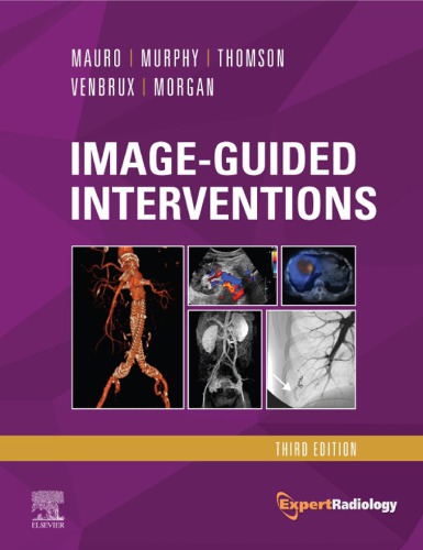 Image-Guided Interventions (Expert Radiology Series)