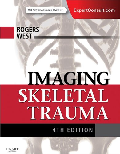 Imaging skeletal trauma