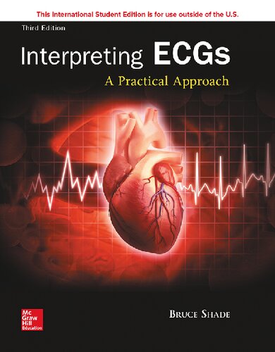 Interpreting ECGs: A Practical Approach