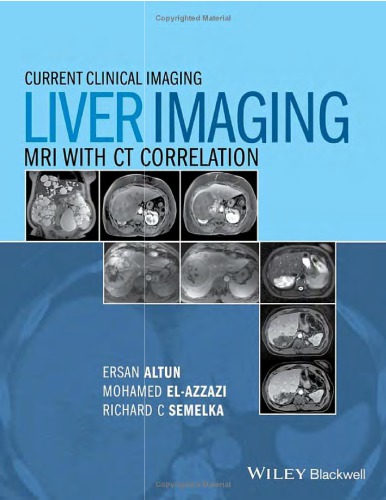 Liver imagaing MRI with CT correlation.