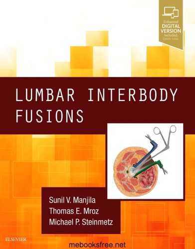 Lumbar Interbody Fusions
