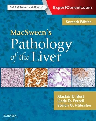 MacSweenÃ¢â‚¬â„¢s Pathology of the Liver