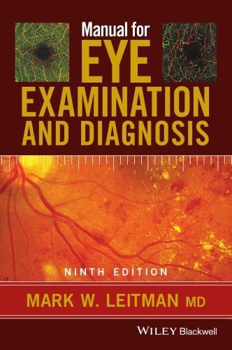 Manual For Eye Examination And Diagnosis 9Th Edition