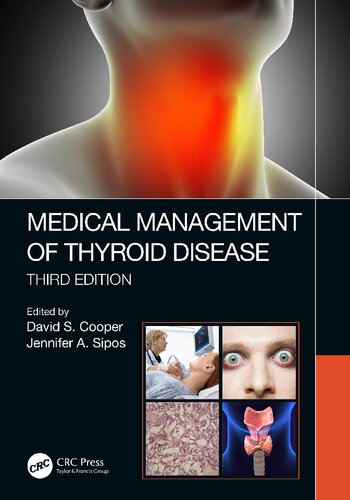 Medical Management of ThyroidÃ‚Â Disease