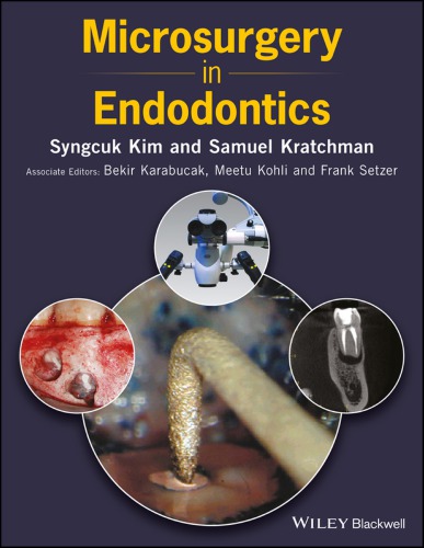 Microsurgery in endodontics