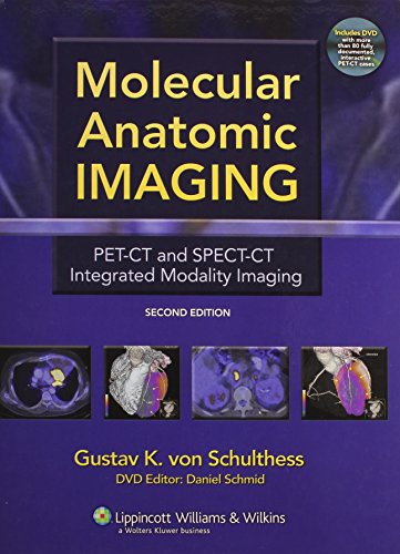 Molecular Anatomic Imaging: PET-CT and SPECT-CT Integrated Modality Imaging (2nd Edition)