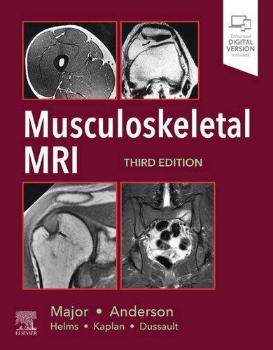 Musculoskeletal Mri 3Rd Edition