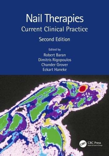 Nail Therapies Current Clinical Practice 2Nd Edition