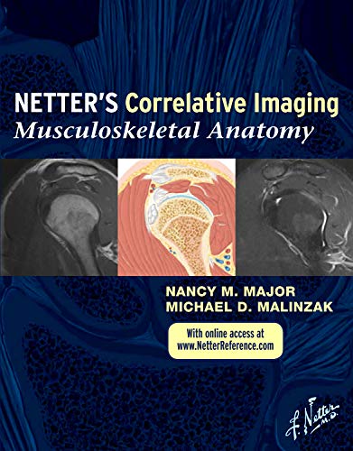 NetterÃ¢â‚¬â„¢s Correlative Imaging: Musculoskeletal Anatomy: with Online Access at www.NetterReference.com, 1e