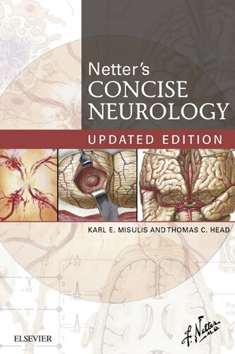 Netter's Concise Neurology Updated Edition (Netter Clinical Science)