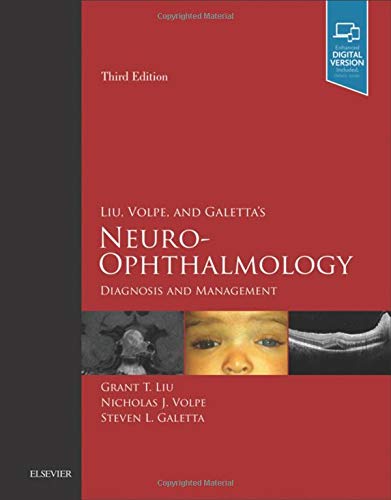 Neuro-Ophthalmology: Diagnosis And Management, Book With Dvd-Rom