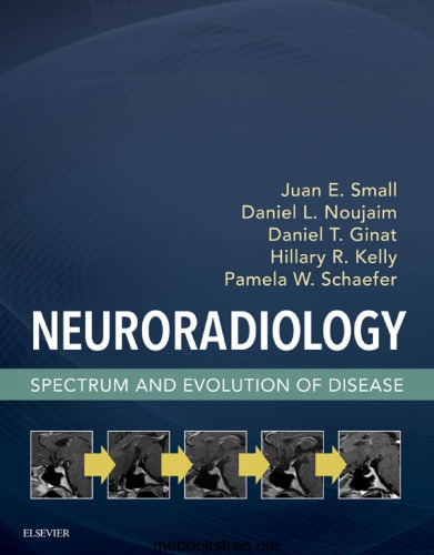 Neuroradiology: Spectrum and Evolution of Disease