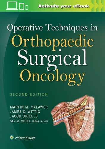 Operative Techniques In Orthopaedic Surgical Oncology 2Nd Edition