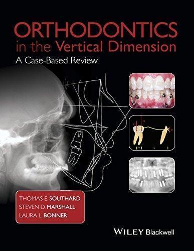 Orthodontics In The Vertical Dimension A Case Based Review