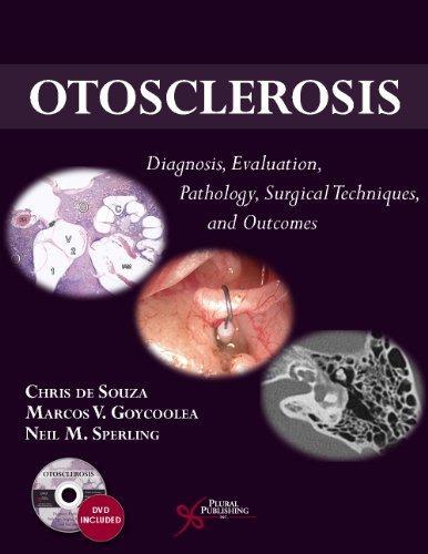 Otosclerosis Diagnosis Evaluation Pathology Surgical Techniques And Outcomes