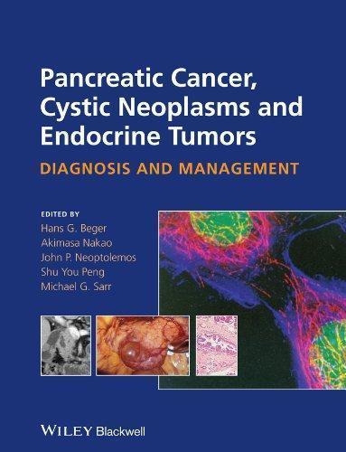 Pancreatic Cancer Cystic Neoplasms And Endocrine Tumors Diagnosis And Management