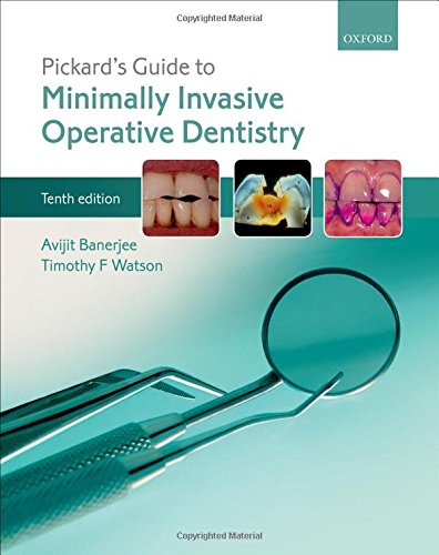 Pickard?s Guide to Minimally Invasive Operative Dentistry (10th Edition)