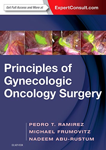 Principles Of Gynecologic Oncology Surgery
