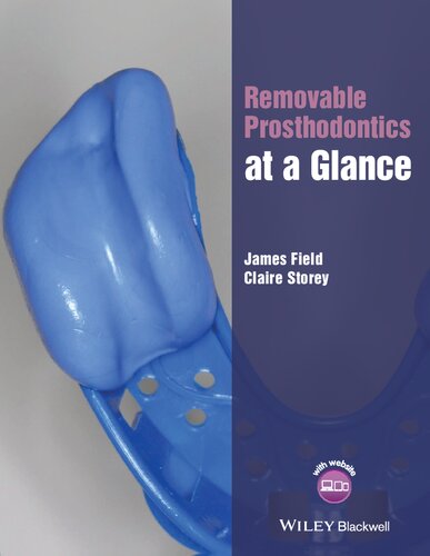 Removable prosthodontics at a glance