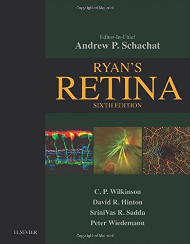 RyanÃ¢â‚¬â„¢s Retina