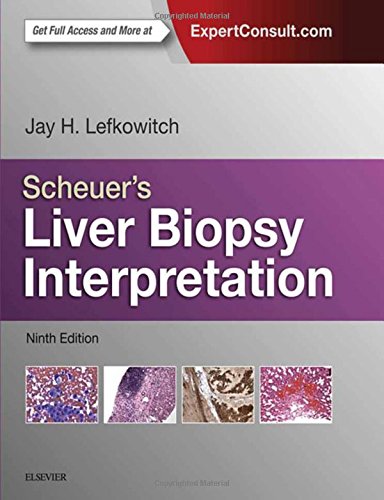 ScheuerÃ¢â‚¬â„¢s Liver Biopsy Interpretation, 9e