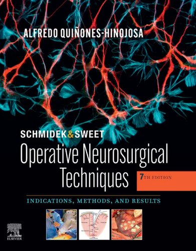 Schmidek and Sweet: Operative Neurosurgical Techniques