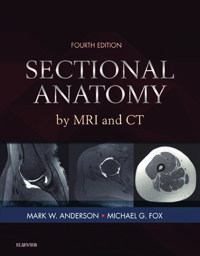 Sectional Anatomy by MRI and CT
