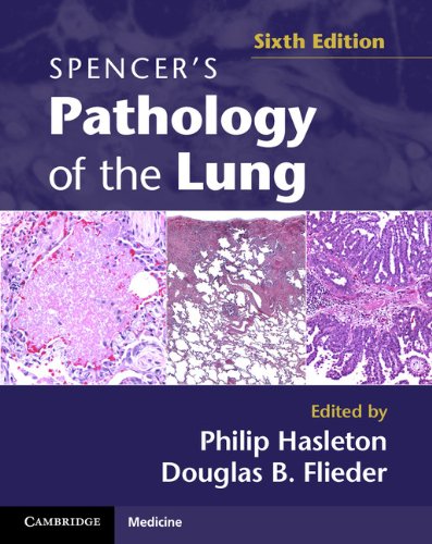 Spencer?s Pathology of the Lung (6th Edition) ? 2 Part Set
