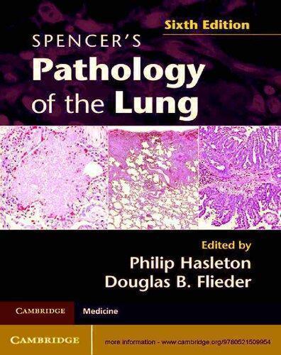 Spencers Pathology Of The Lung 6Th Edition