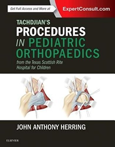 TachdjianÃ¢â‚¬â„¢s Procedures in Pediatric Orthopaedics: From the Texas Scottish Rite Hospital for Children