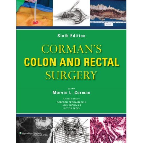 Corman's Colon and Rectal Surgery (COLON AND RECTAL SURGERY (CORMAN)) (PDF/EPUB Version)
