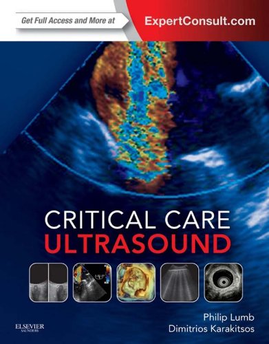 Critical Care Ultrasound (PDF/EPUB Version)