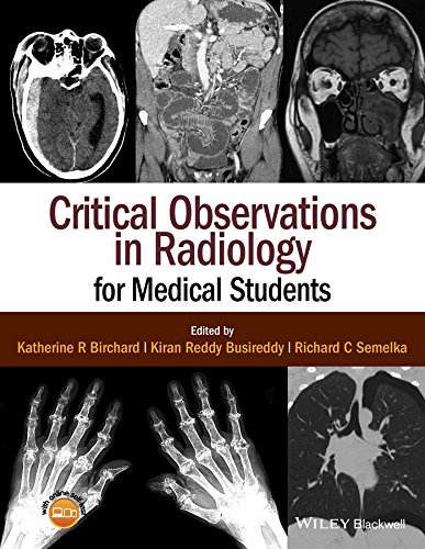 Critical Observations in Radiology for Medical Students (PDF/EPUB Version)