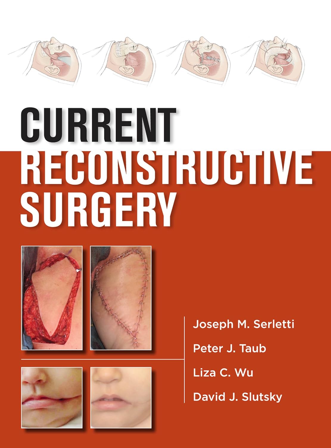 Current Reconstructive Surgery (Lange Current) (PDF/EPUB Version)