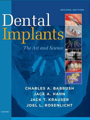 Dental Implants: The Art and Science (PDF/EPUB Version)