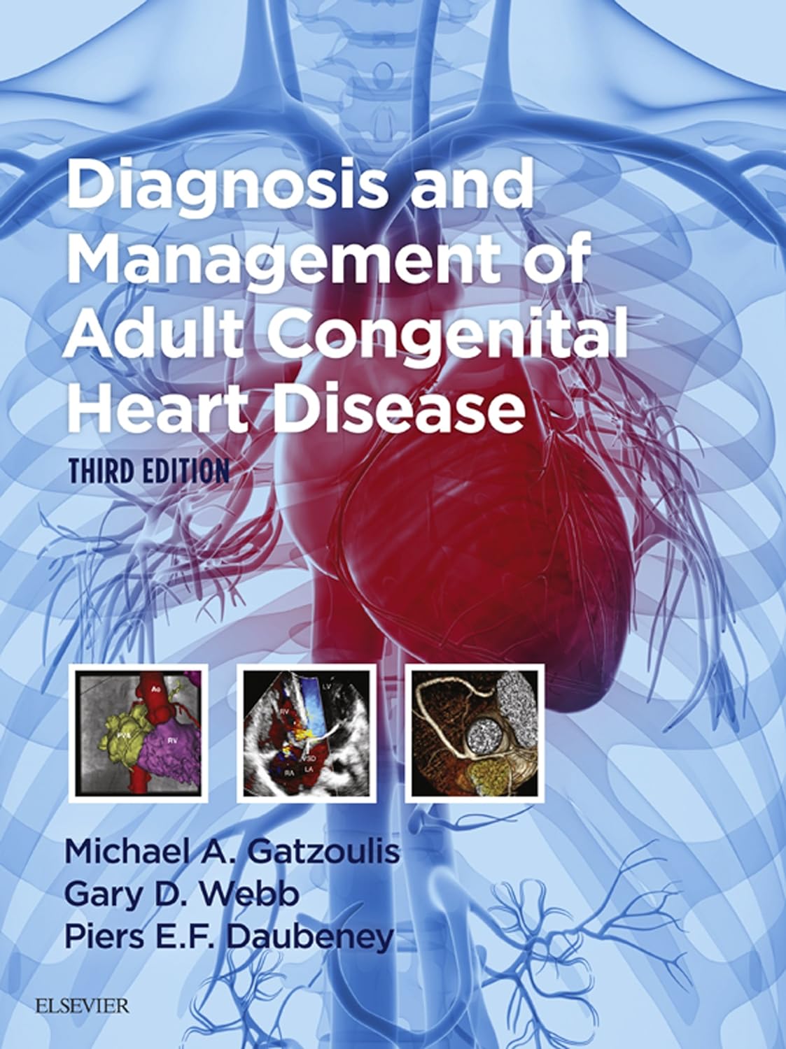 Diagnosis and Management of Adult Congenital Heart Disease E-Book (PDF/EPUB Version)