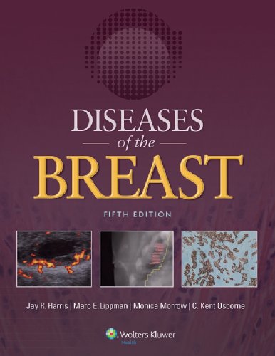 Diseases of the Breast (PDF/EPUB Version)