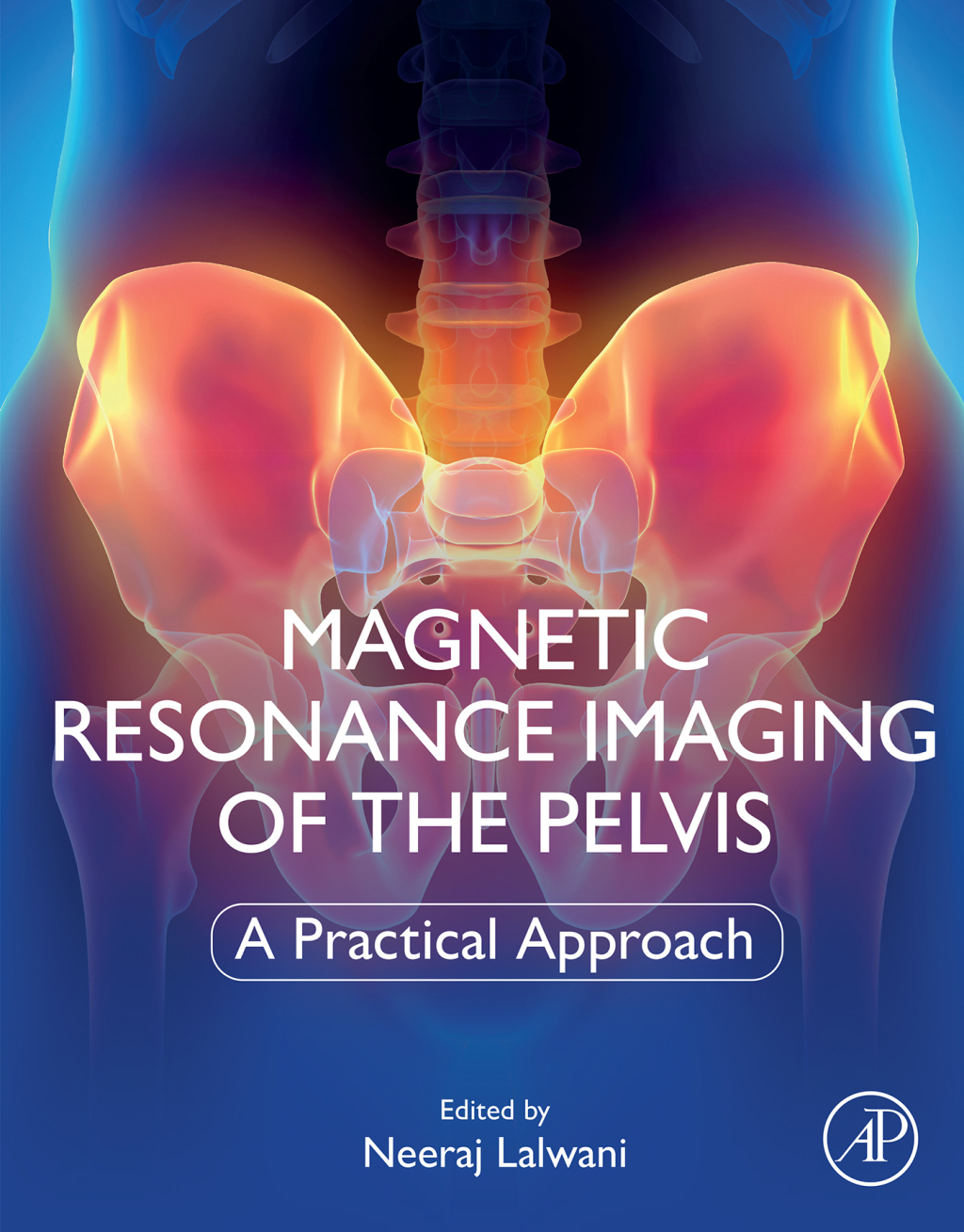 Magnetic Resonance Imaging of The Pelvis A Practical Approach 1st Edition