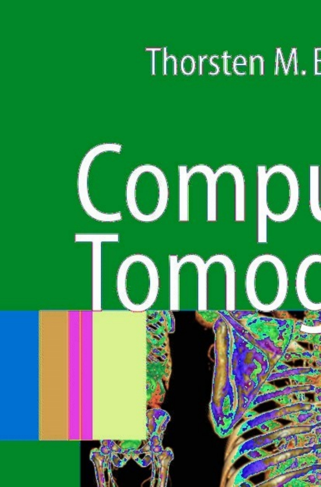 Computed Tomography From Photon Statistics to Modern Cone-Beam CT 